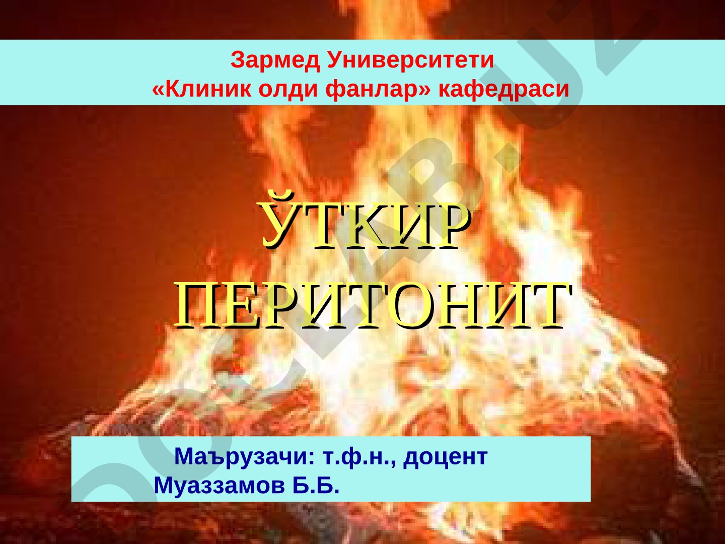 Ўткир перитонит