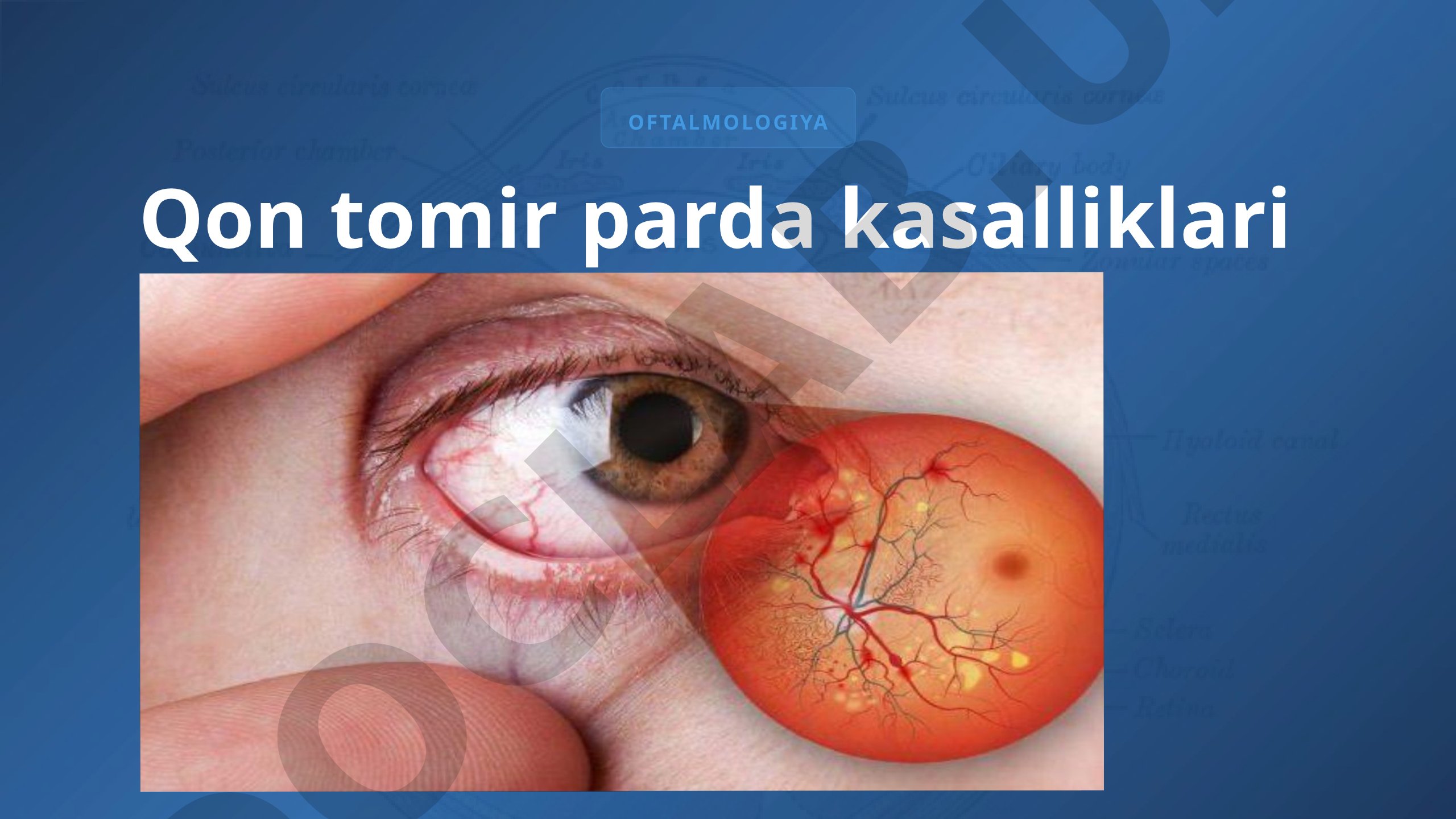 Oftalmologiya: Qon tomir parda kasalliklari