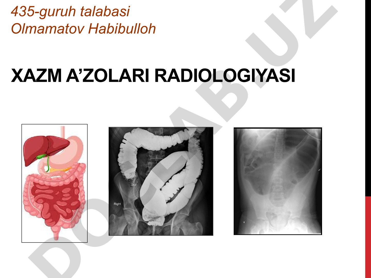 Xazm a'zolari radiologiyasi