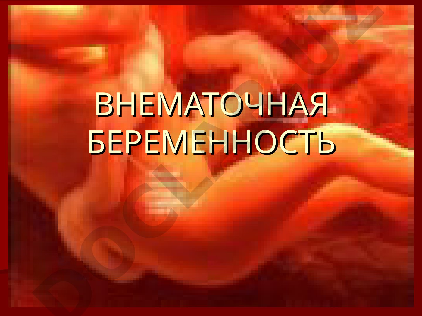 Классификация, факторы риска и распространенность внематочной беременности