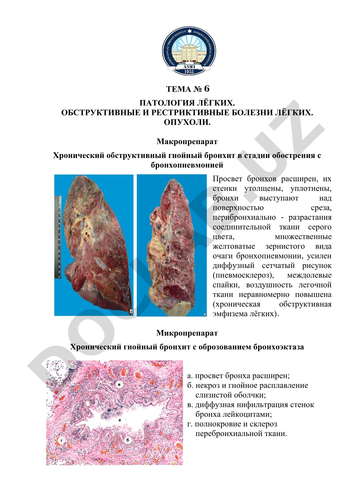 Патология лёгких. Обструктивные и рестриктивные болезни лёгких. Опухоли.