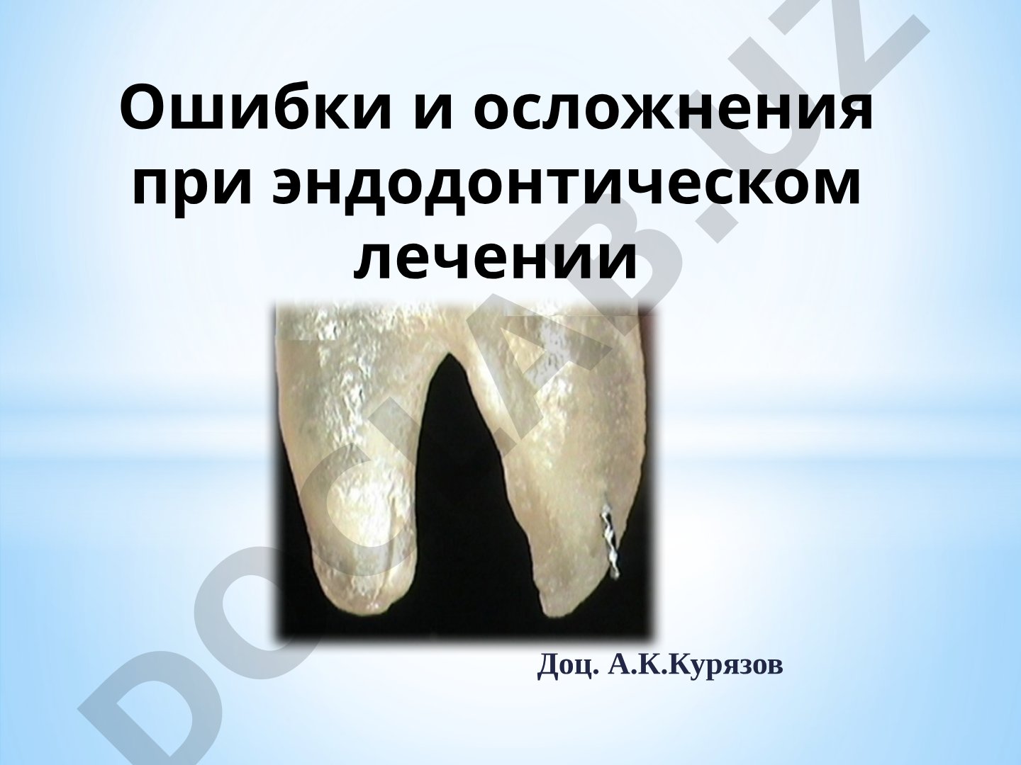 Ошибки и осложнения при эндодонтическом лечении