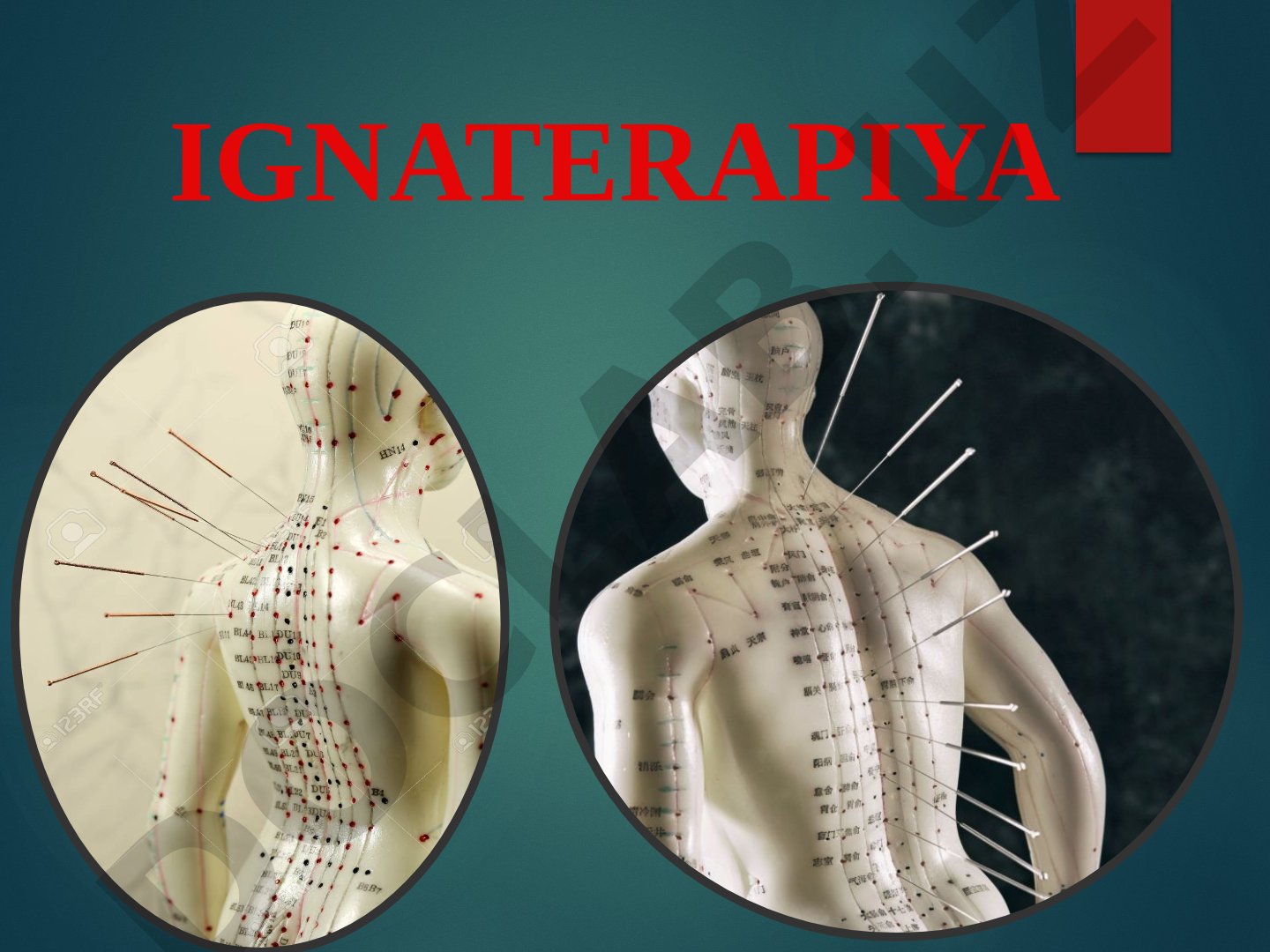 Ignaterapiya asoslari, 12 juft meridianlar, aurikuloterapiya va davolanadigan kasalliklar