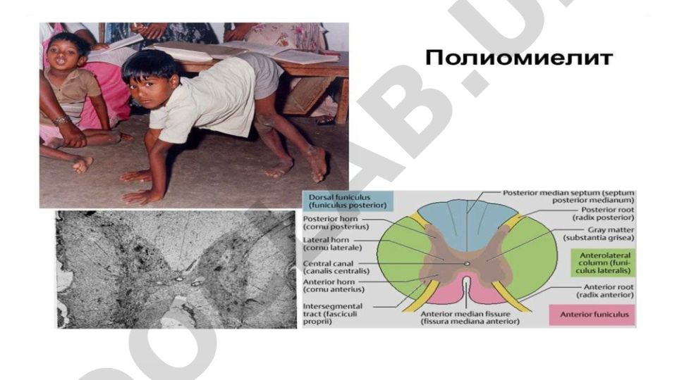 Nevrologik va psixiatrik kasalliklar