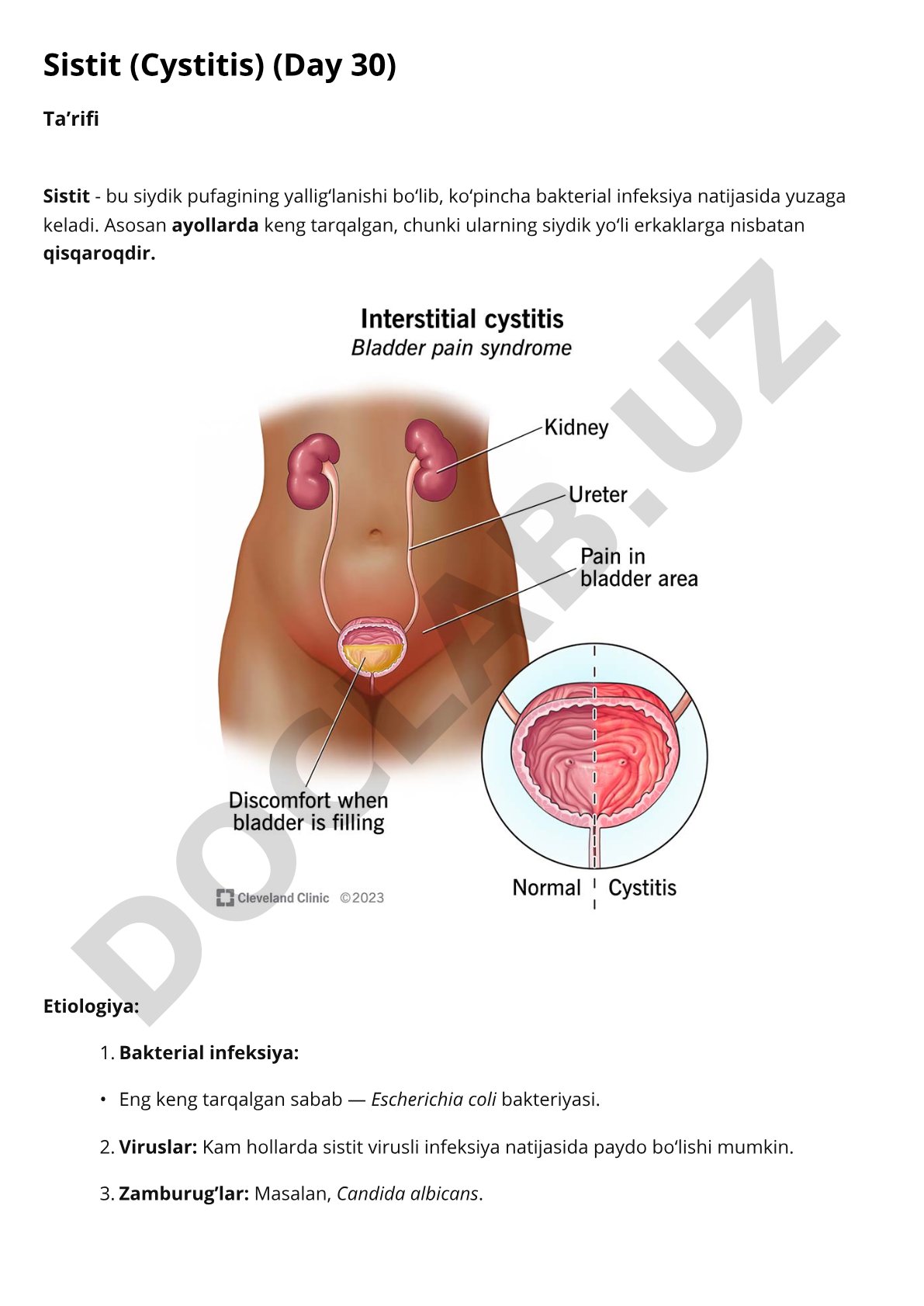 Sistit kasalligi: etiologiyasi, patogenezi va klinik belgilari