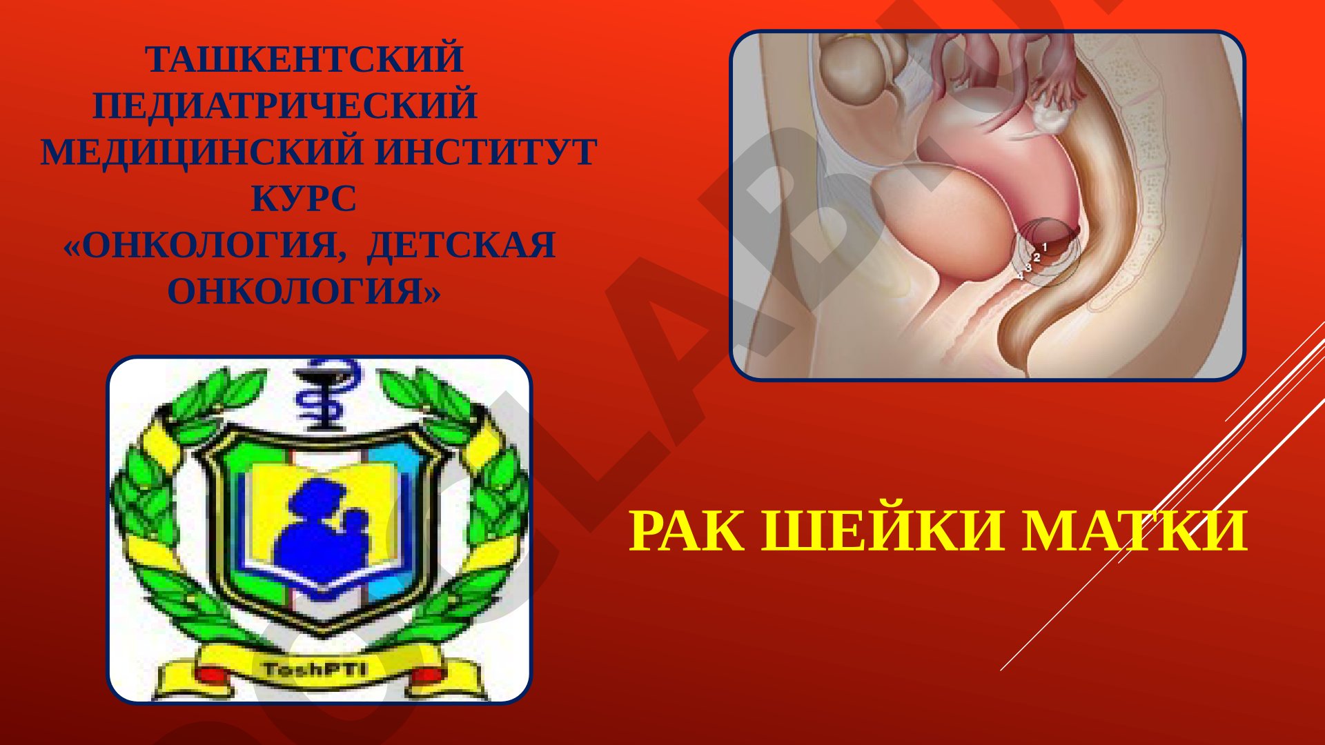 Рак шейки матки: анатомия и кровоснабжение