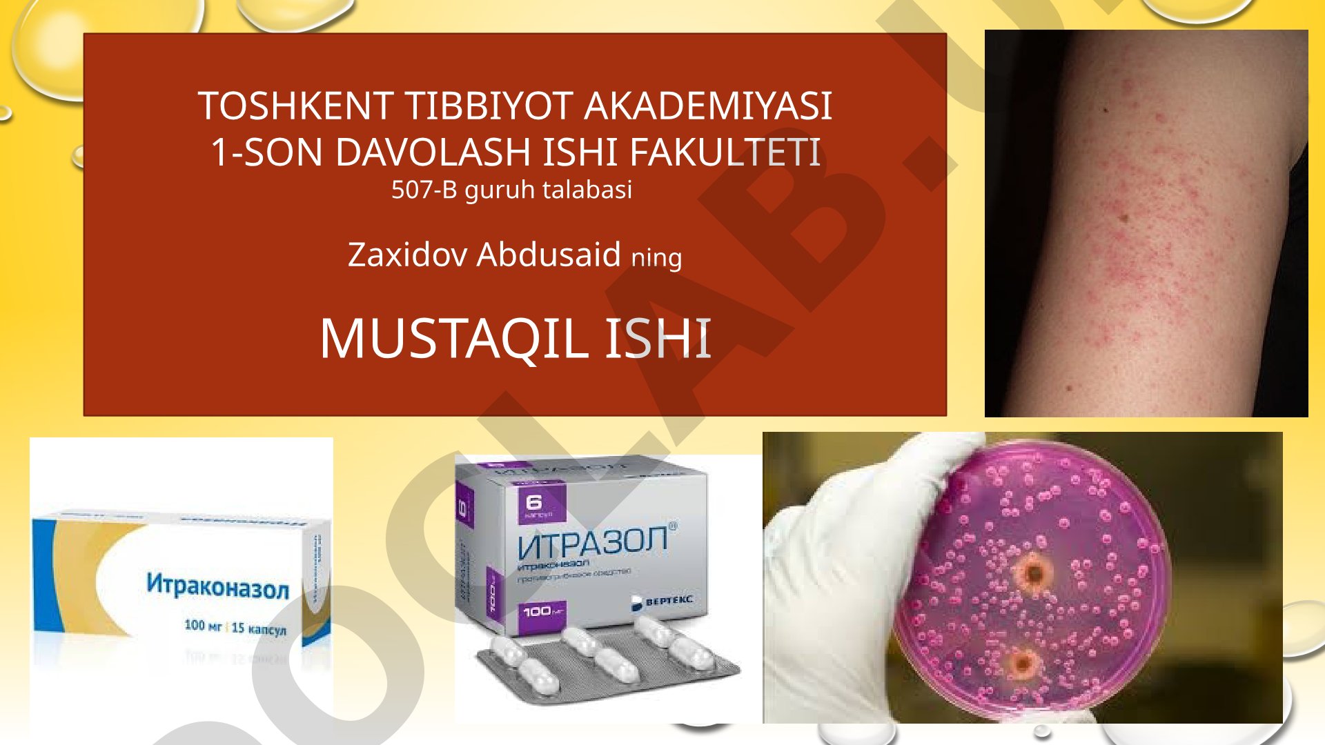 Zamburug`larga qarshi dorivositalarining klinik farmakologiyasi