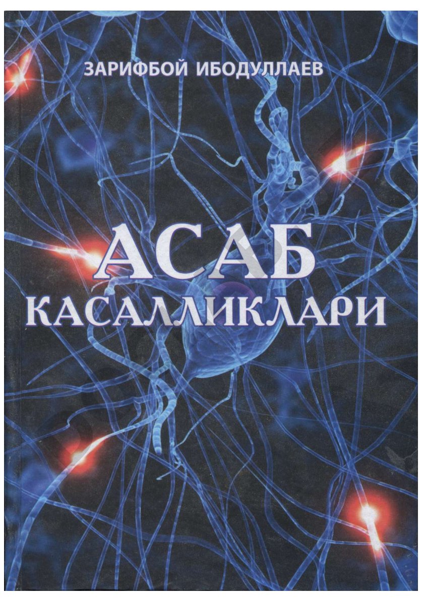 Асаб касалликлари