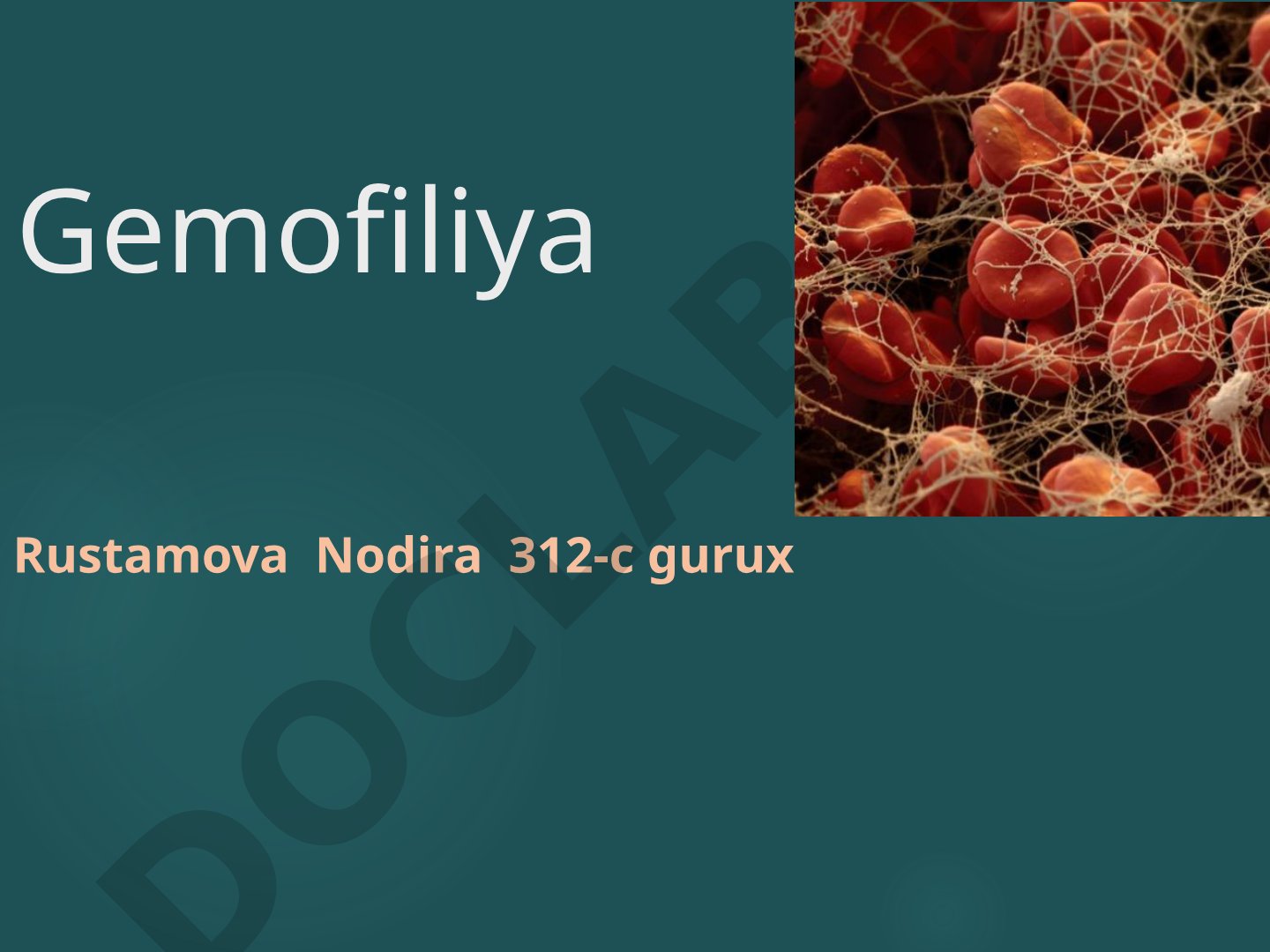 Gemofiliya turlari, irsiylanishi va klinik kechishi haqida ma'lumot