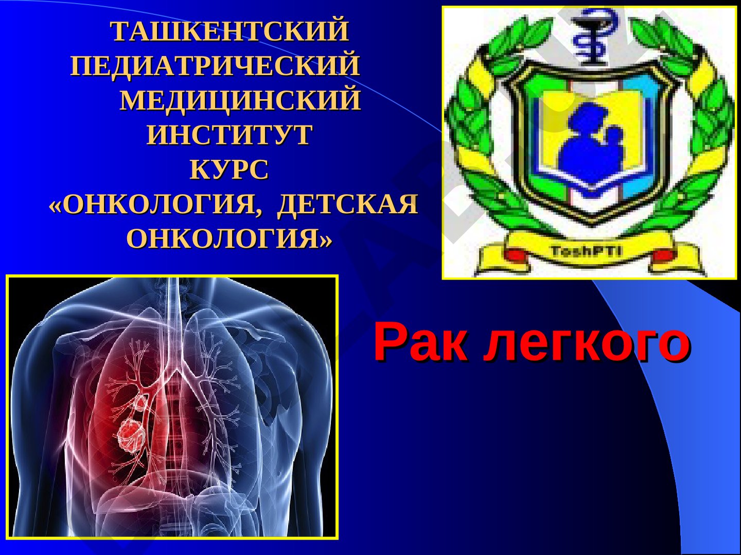 Рак легкого: анатомия и лимфоотток