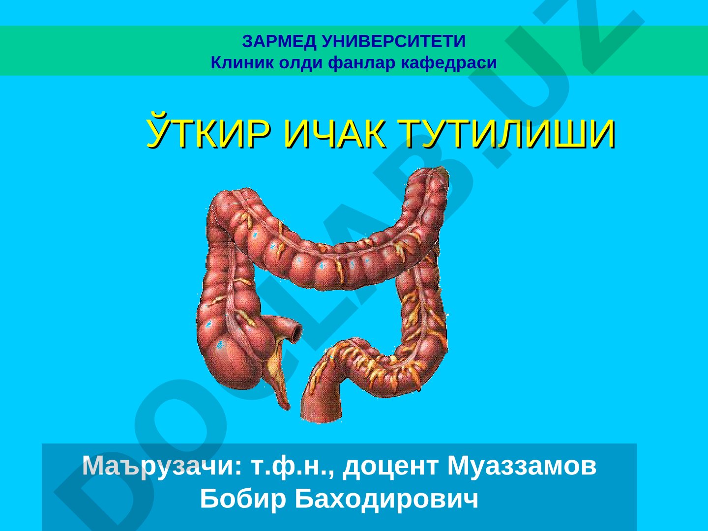Ўткир ичак тутилиши