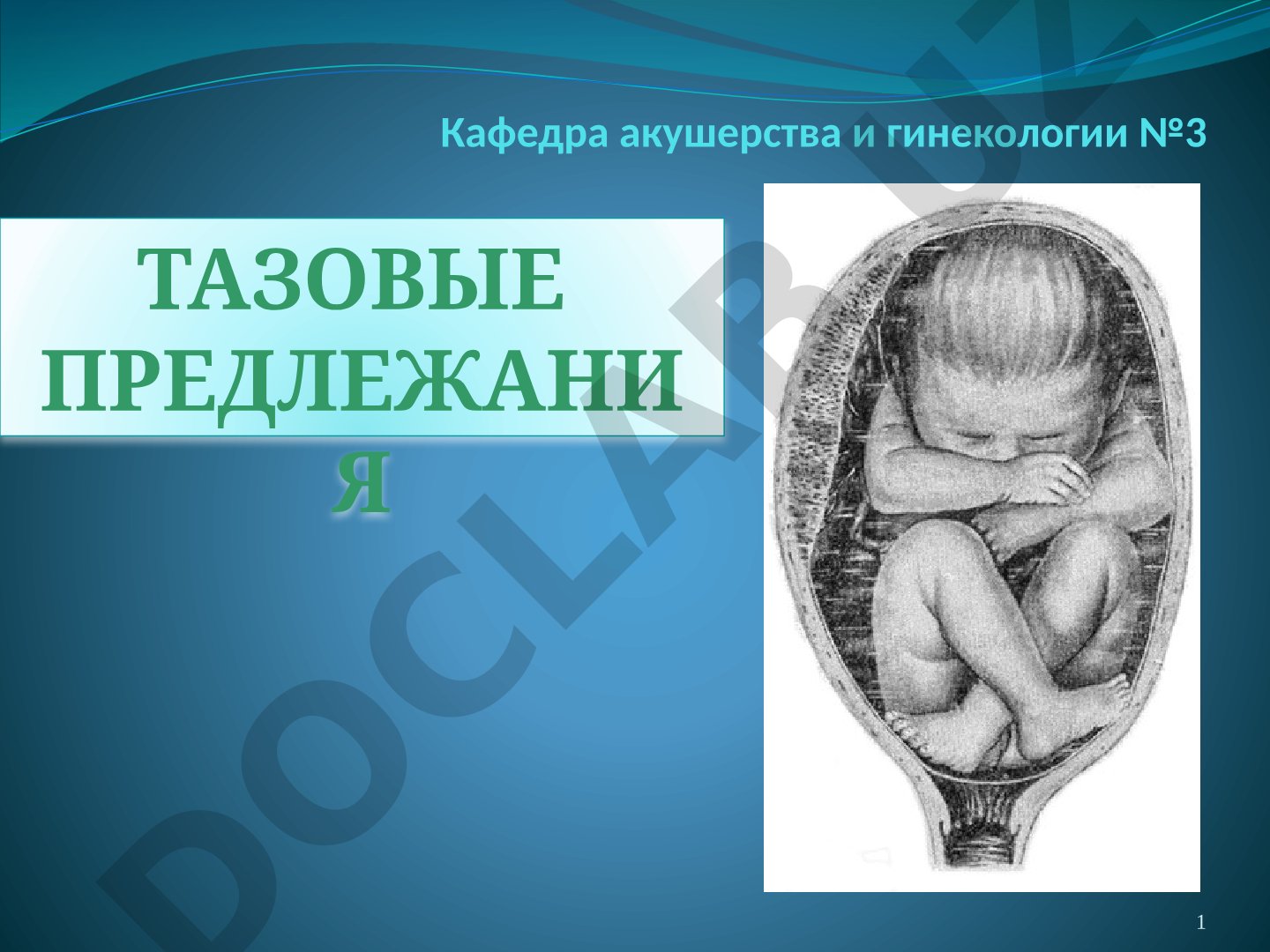 Лекция о тазовом предлежании плода: история, диагностика, методы родоразрешения