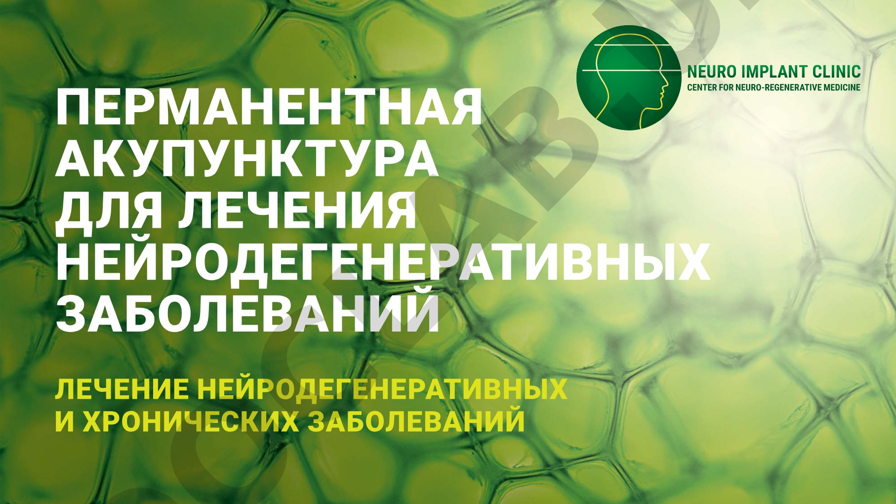 Перманентная акупунктура для лечения нейродегенеративных заболеваний