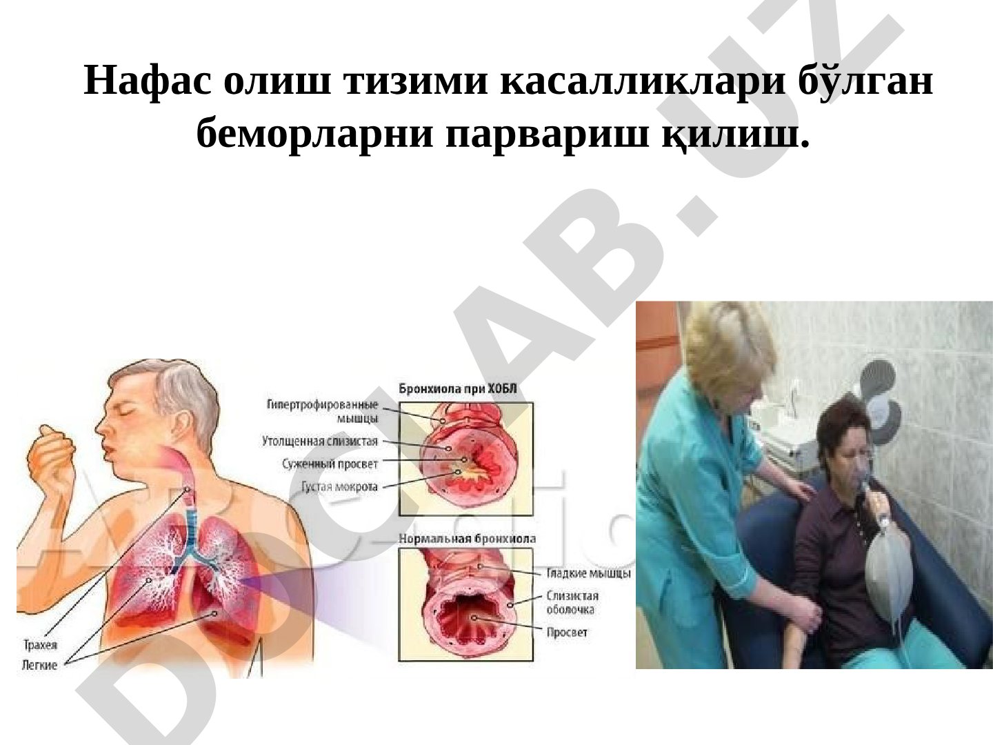 Нафас олиш тизими касалликлари бўлган беморларни парвариш қилиш