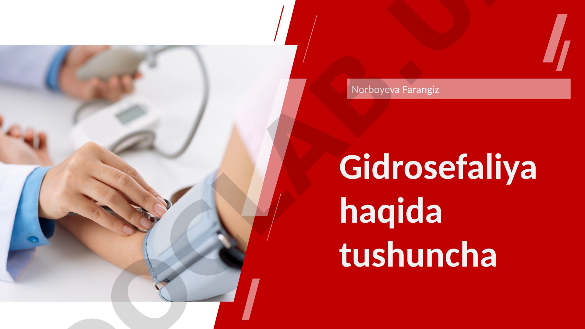 Gidrosefaliya haqida tushuncha