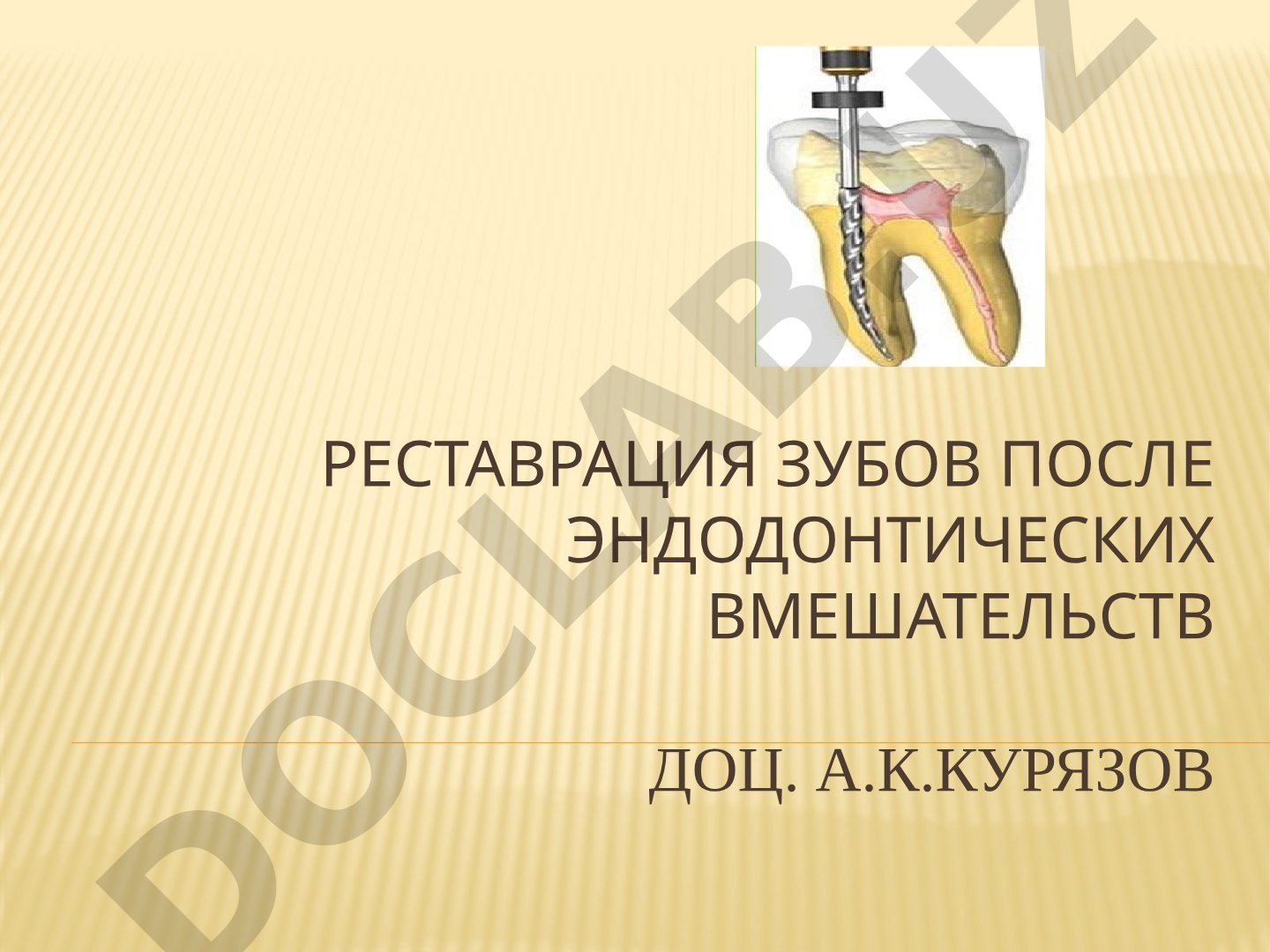 Реставрация зубов после эндодонтических вмешательств с использованием штифтовых конструкций