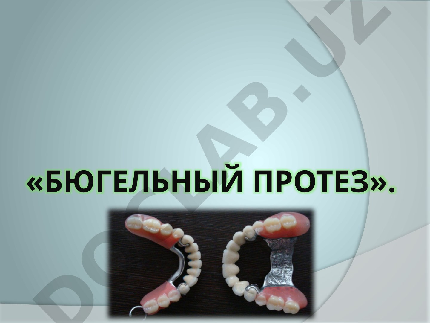 Бюгельный протез