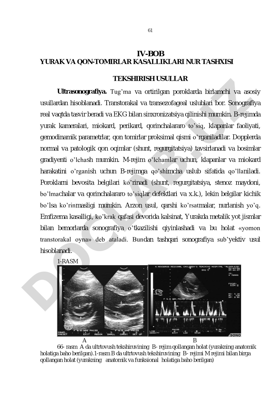 Yurak va qon-tomirlar kasalliklari nur tashxisi tekshirish usullar