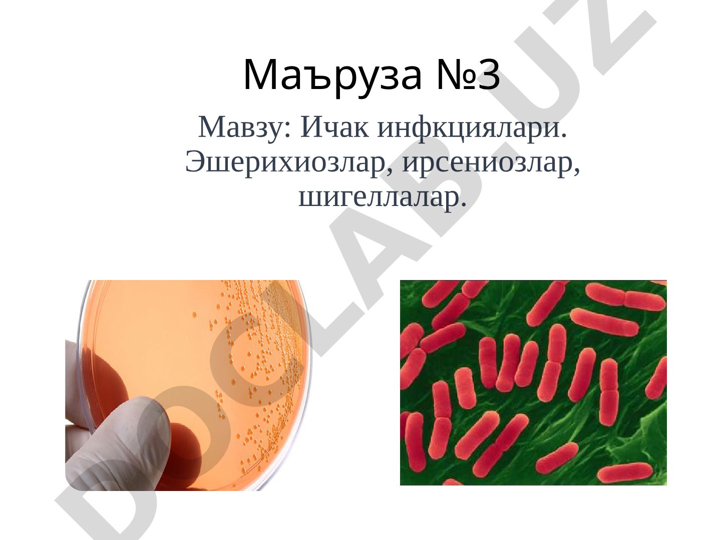 Ичак инфекциялари. Эшерихиозлар, ирсениозлар, шигеллалар