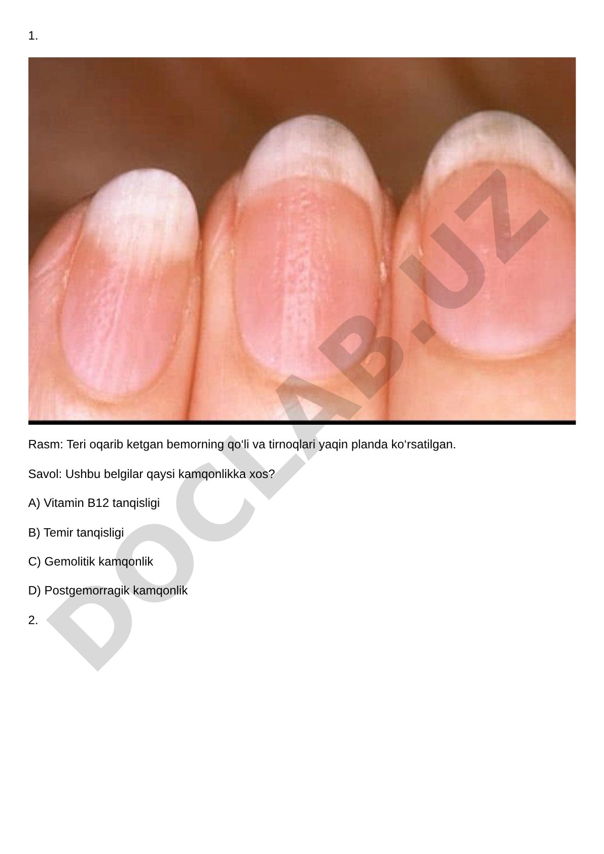 Kamqonlik turlari bo'yicha test savollari