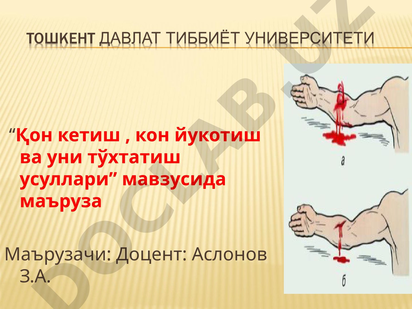 Қон кетиш, кон йукотиш ва уни тўхтатиш усуллари