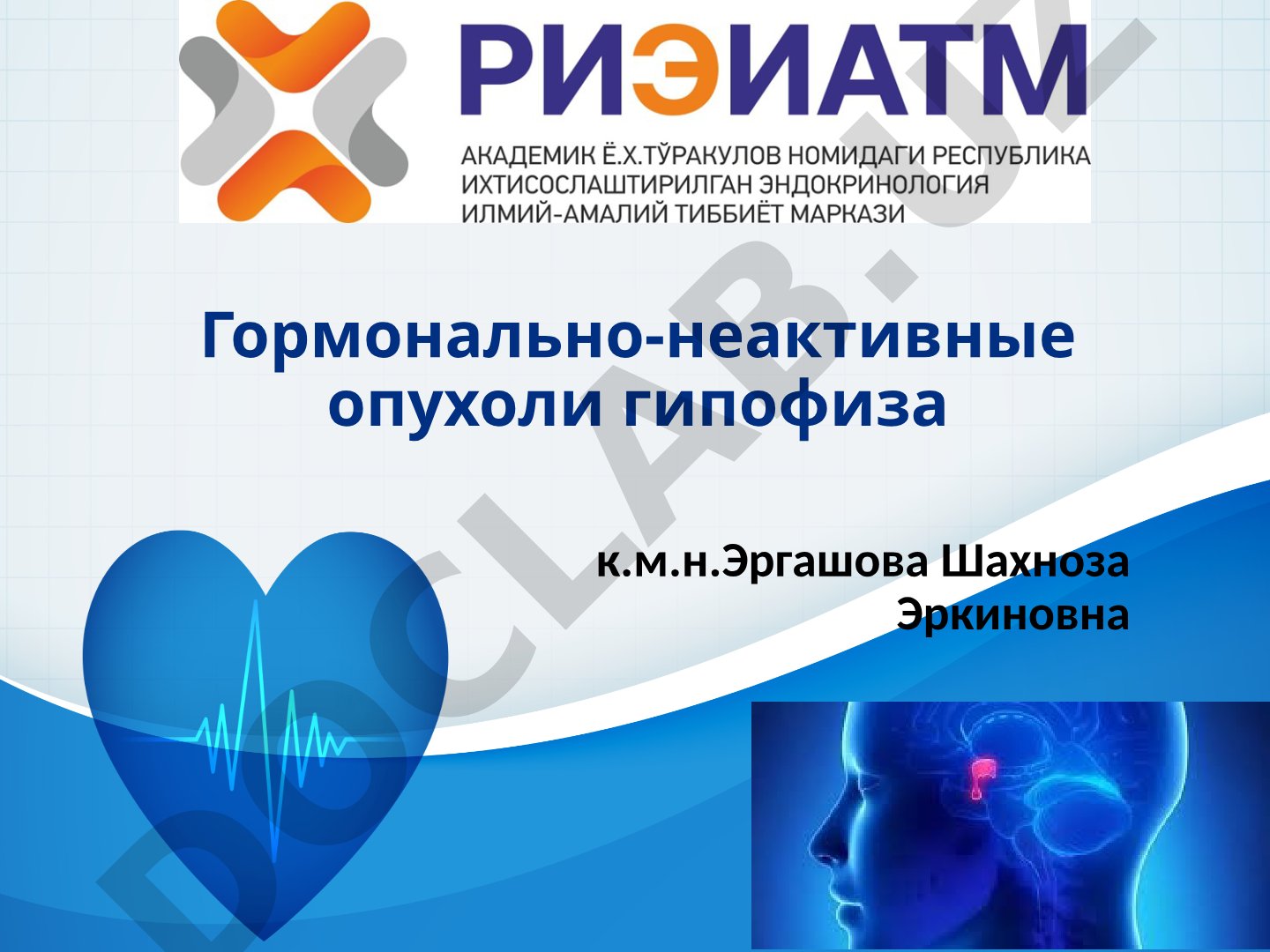Гормонально-неактивные опухоли гипофиза