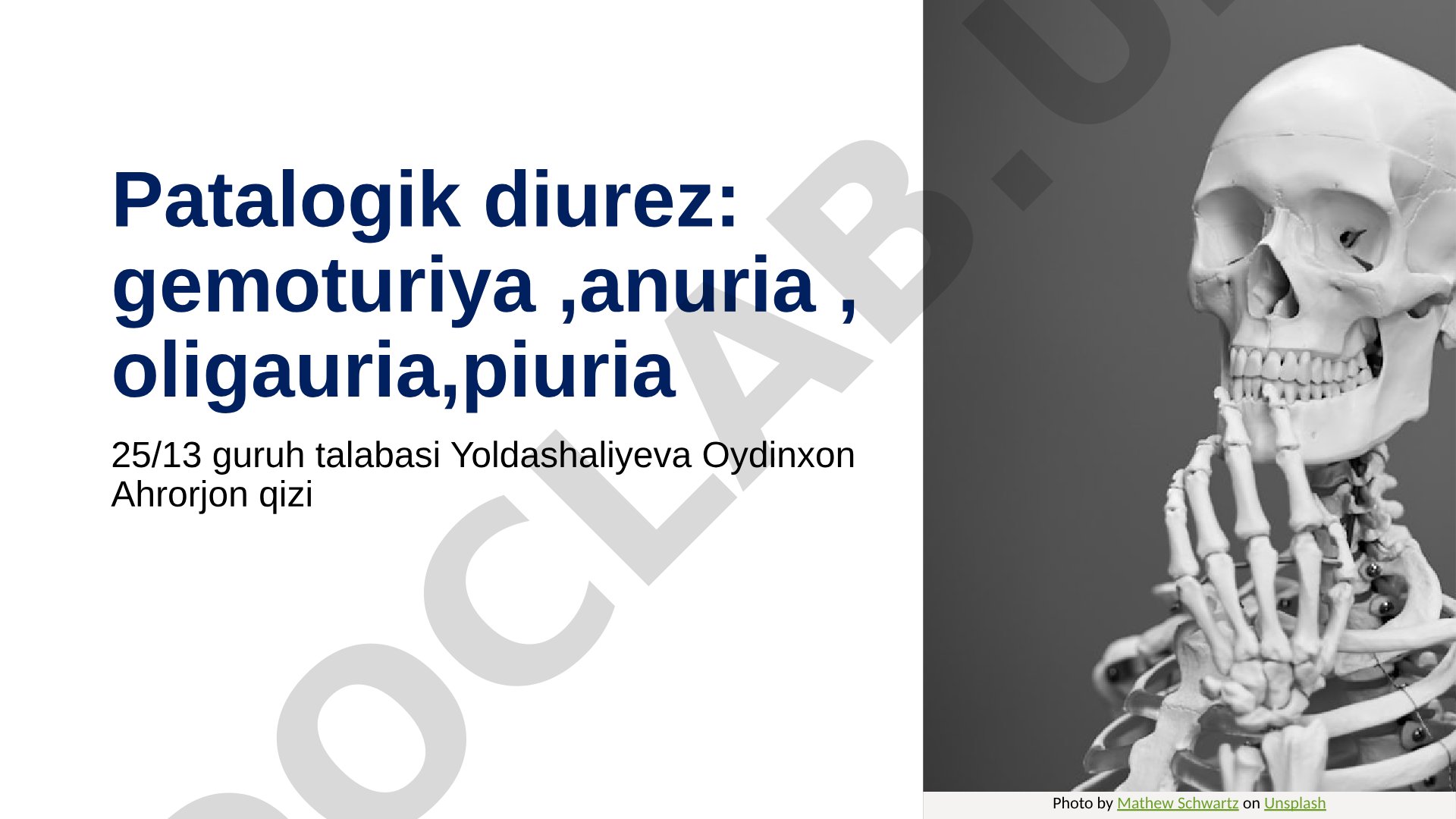 Patalogik diurez: gemoturiya, anuria, oligauria, piuria