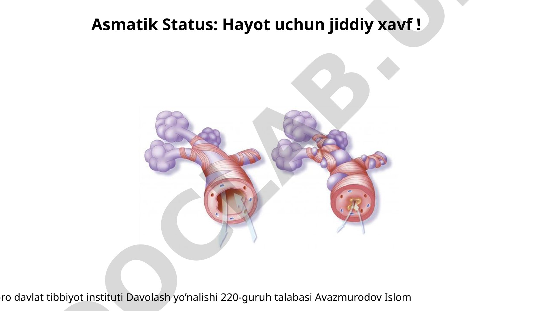 Asmatik Status