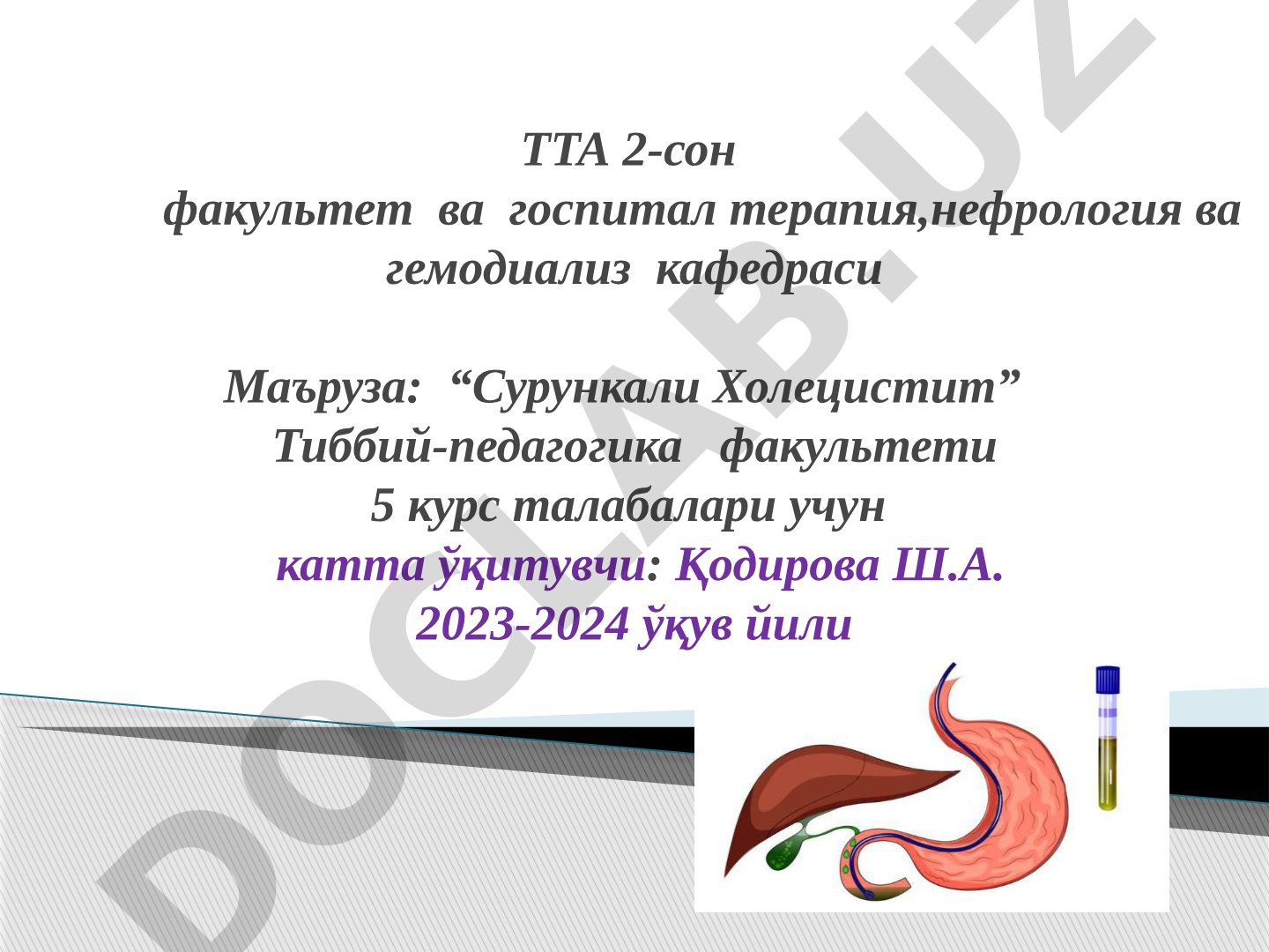 Сурункали Холецистит