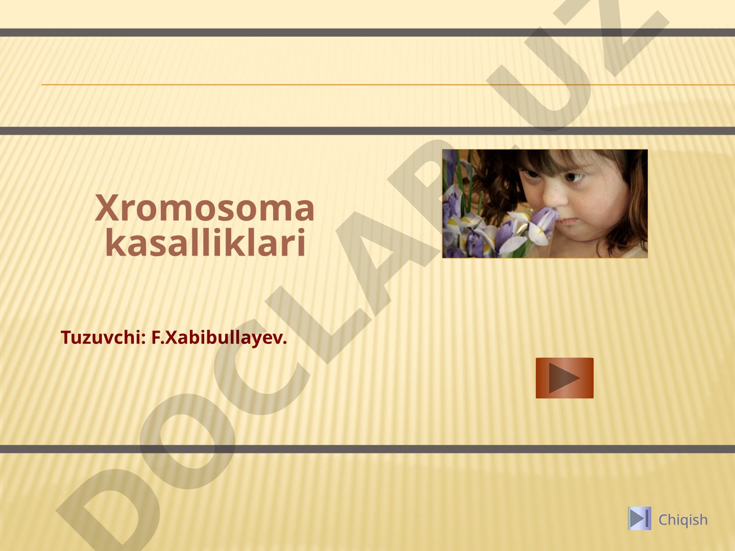 Xromosoma kasalliklari etiologiyasi, patogenezi, klinikasi va diagnostikasi haqida