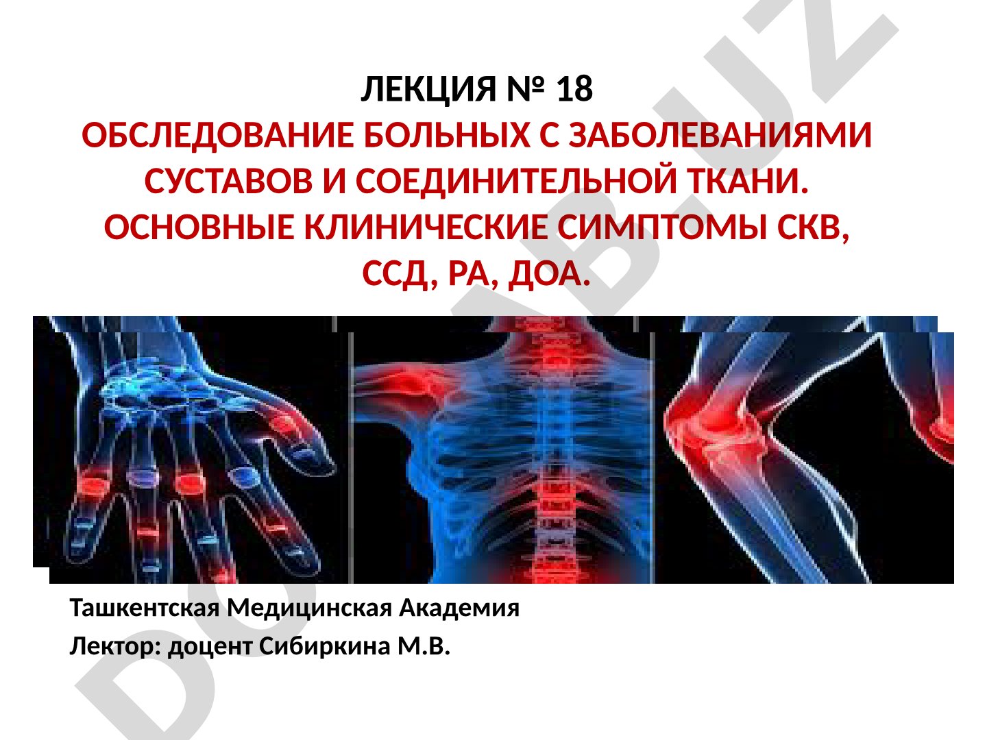 Обследование больных с заболеваниями суставов и соединительной ткани. Основные клинические симптомы СКВ, ССД, РА, ДОА.