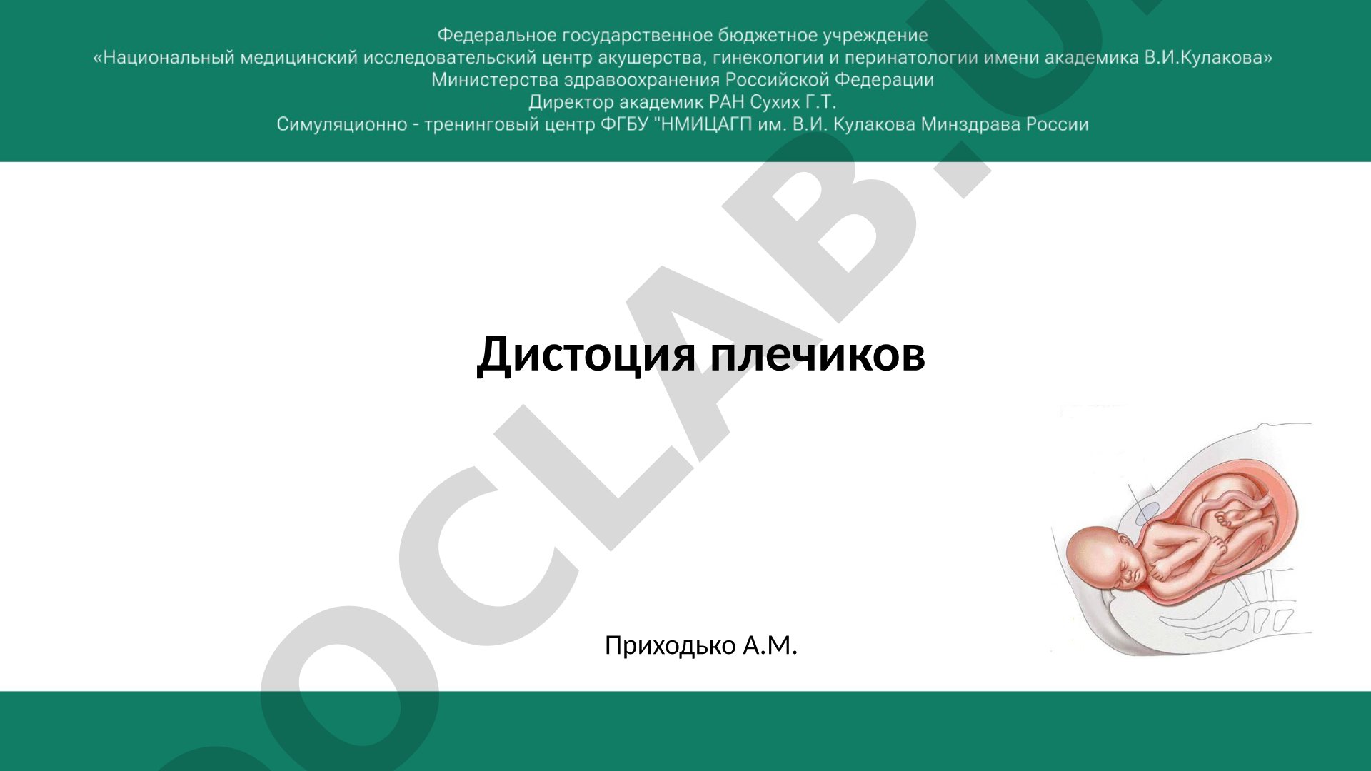 Дистоция плечиков