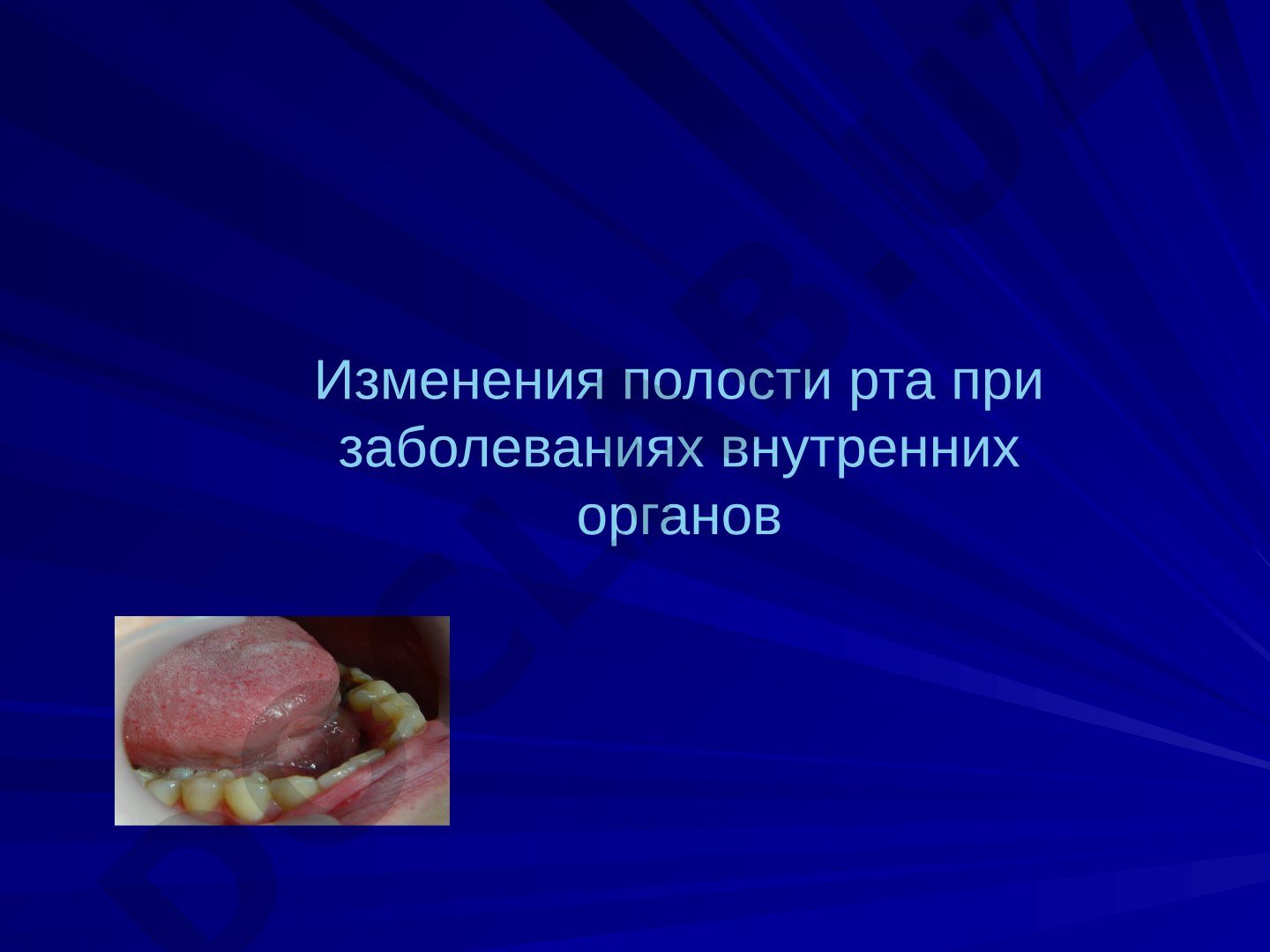 Изменения полости рта при заболеваниях внутренних органов