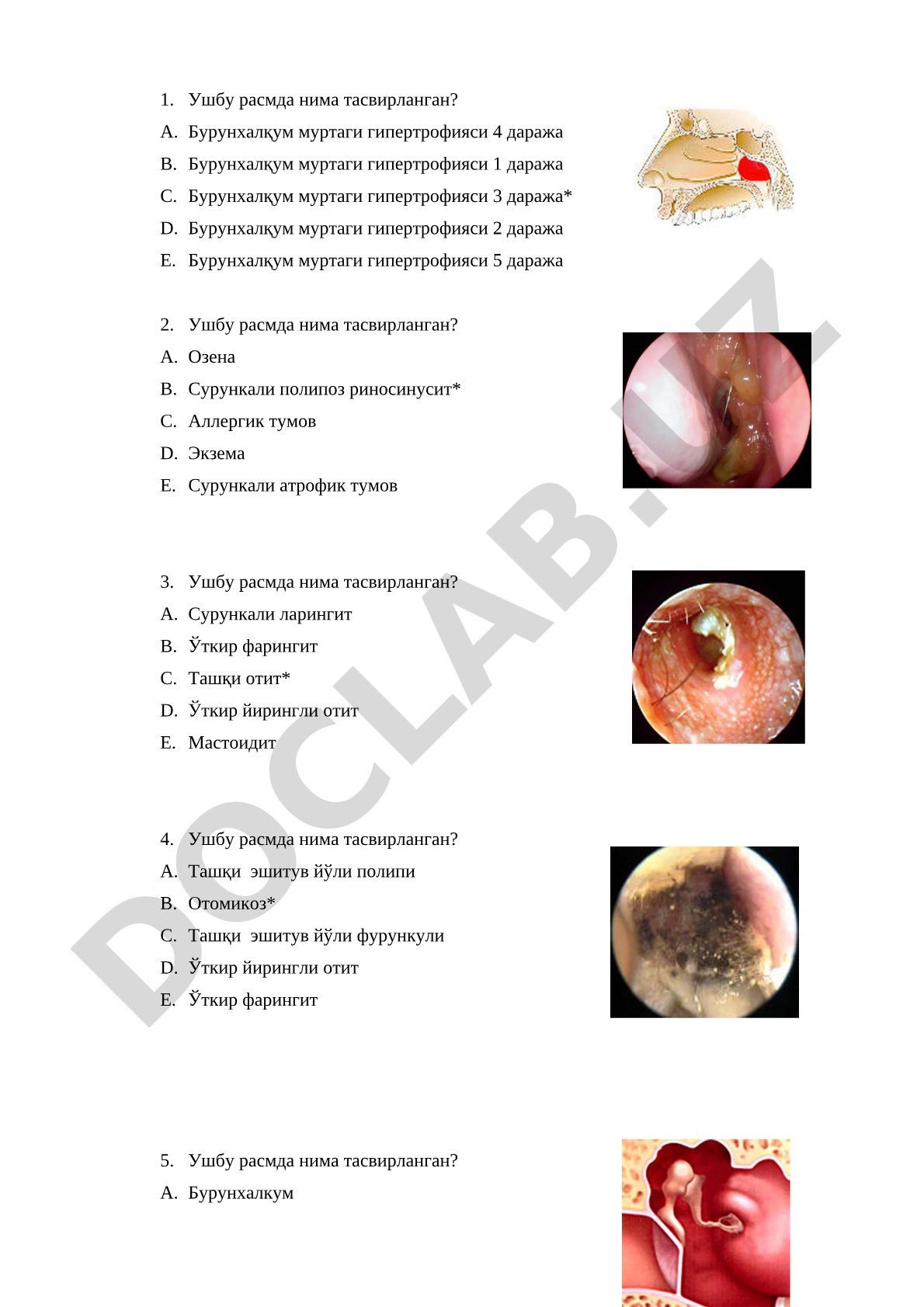 Otorinolaringologiya test savollari