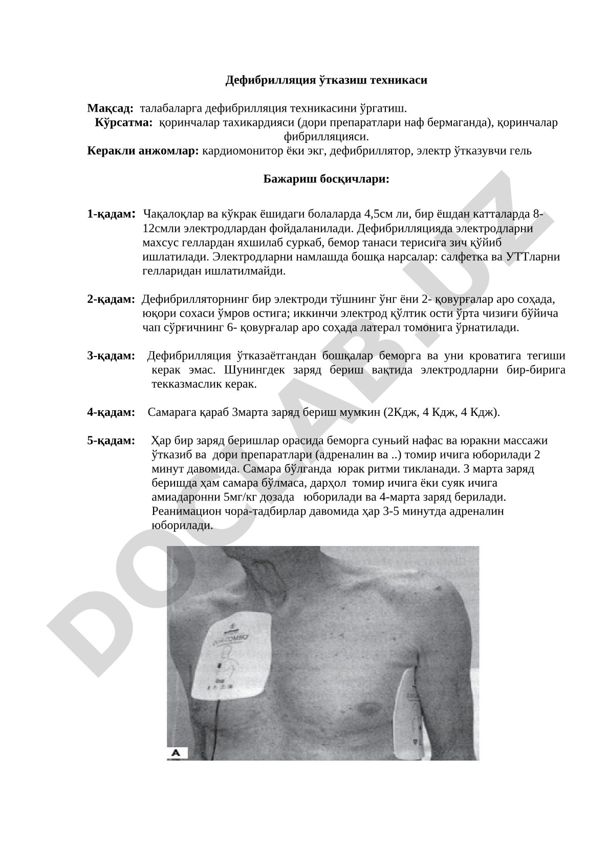 Талабаларга дефибрилляция техникасини ўргатиш: кўрсатмалар, жиҳозлар ва бажариш
