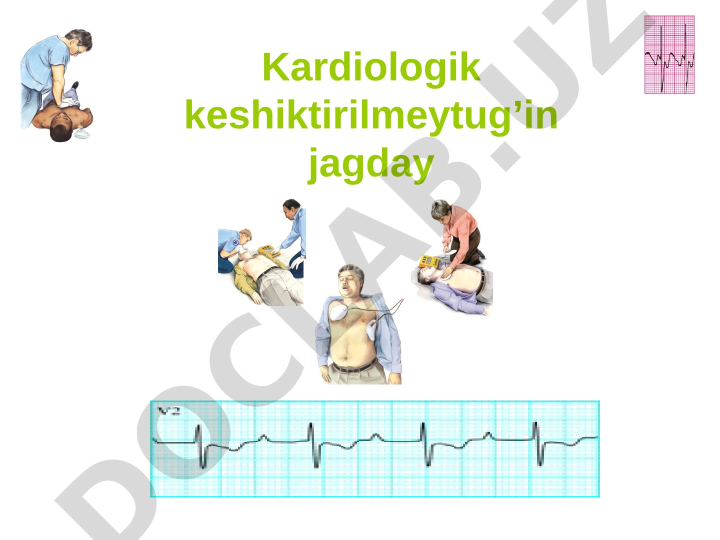 Kardiologik keshiktirilmeytug'in jagday: aritmiyalar va yurak yetishmovchiligi