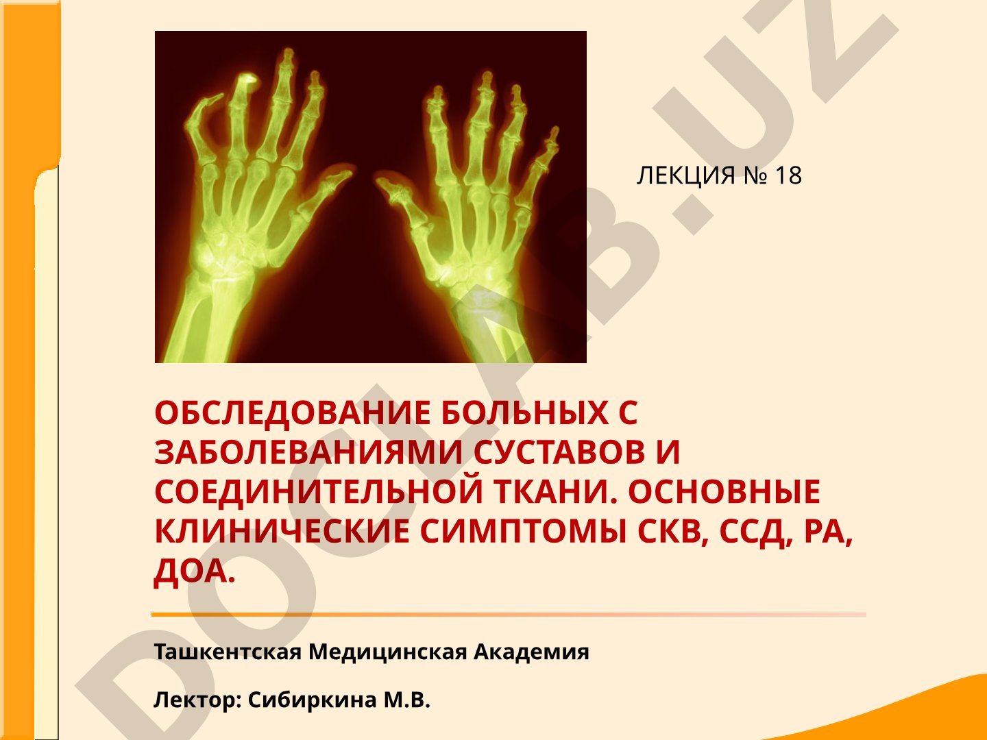 Обследование больных с заболеваниями суставов и соединительной ткани. Основные клинические симптомы СКВ, ССД, РА, ДОА