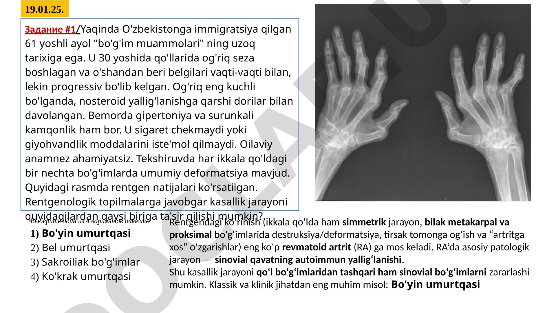 Revmatoid artritda bo'g'im deformatsiyasi va rentgenologik topilmalar