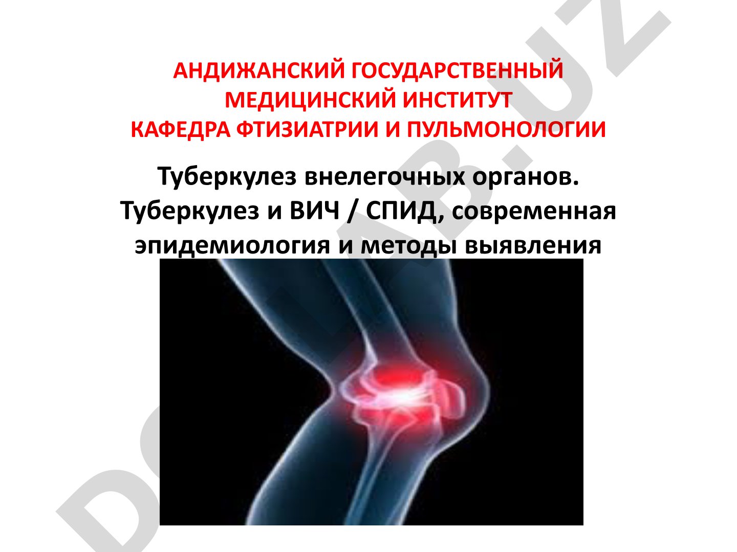 Туберкулез внелегочных органов. Туберкулез и ВИЧ / СПИД, современная эпидемиология и методы выявления