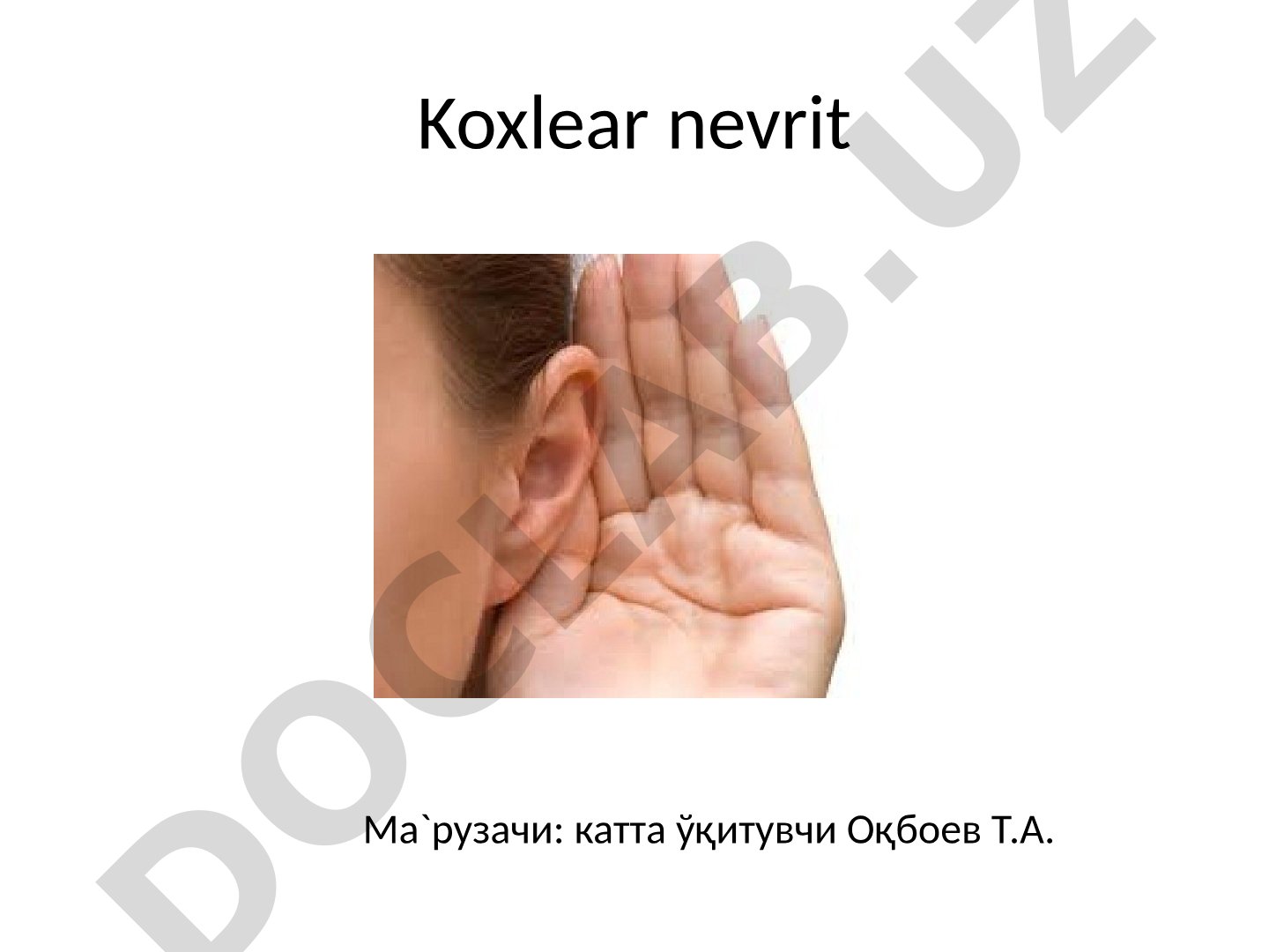 Koxlear nevrit