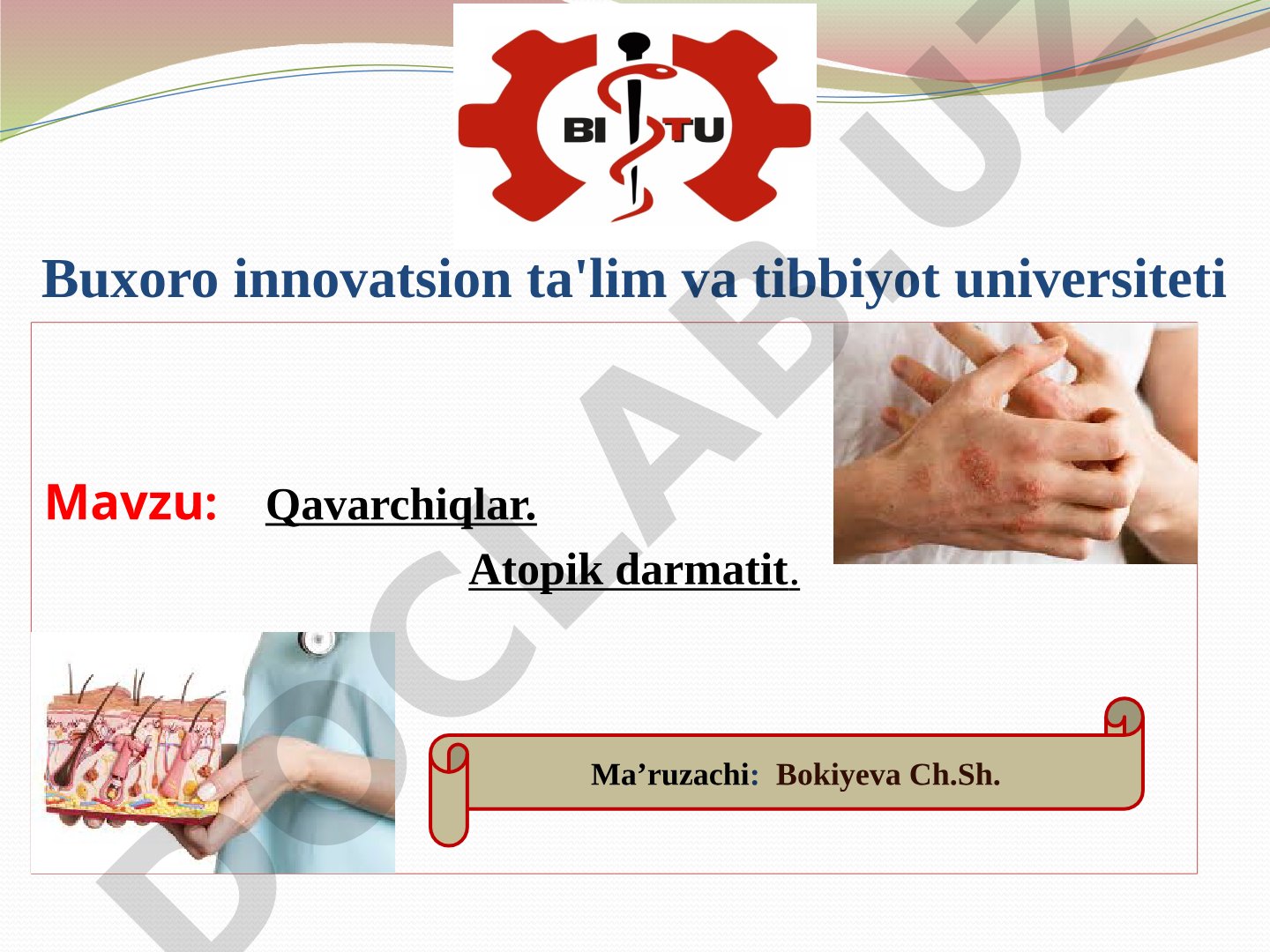 Qavarchiqlar. Atopik dermatit