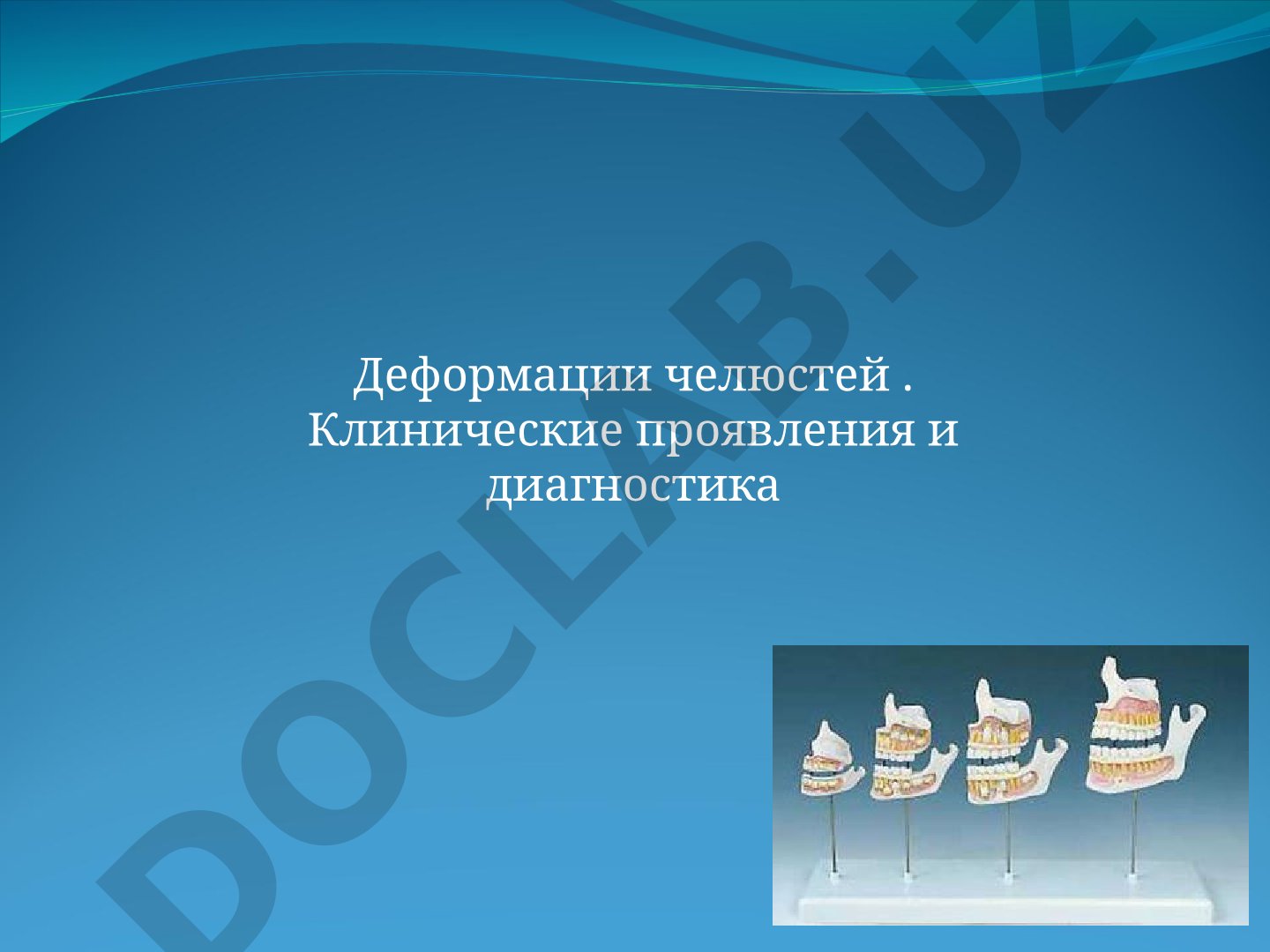Деформации челюстей. Клинические проявления и диагностика