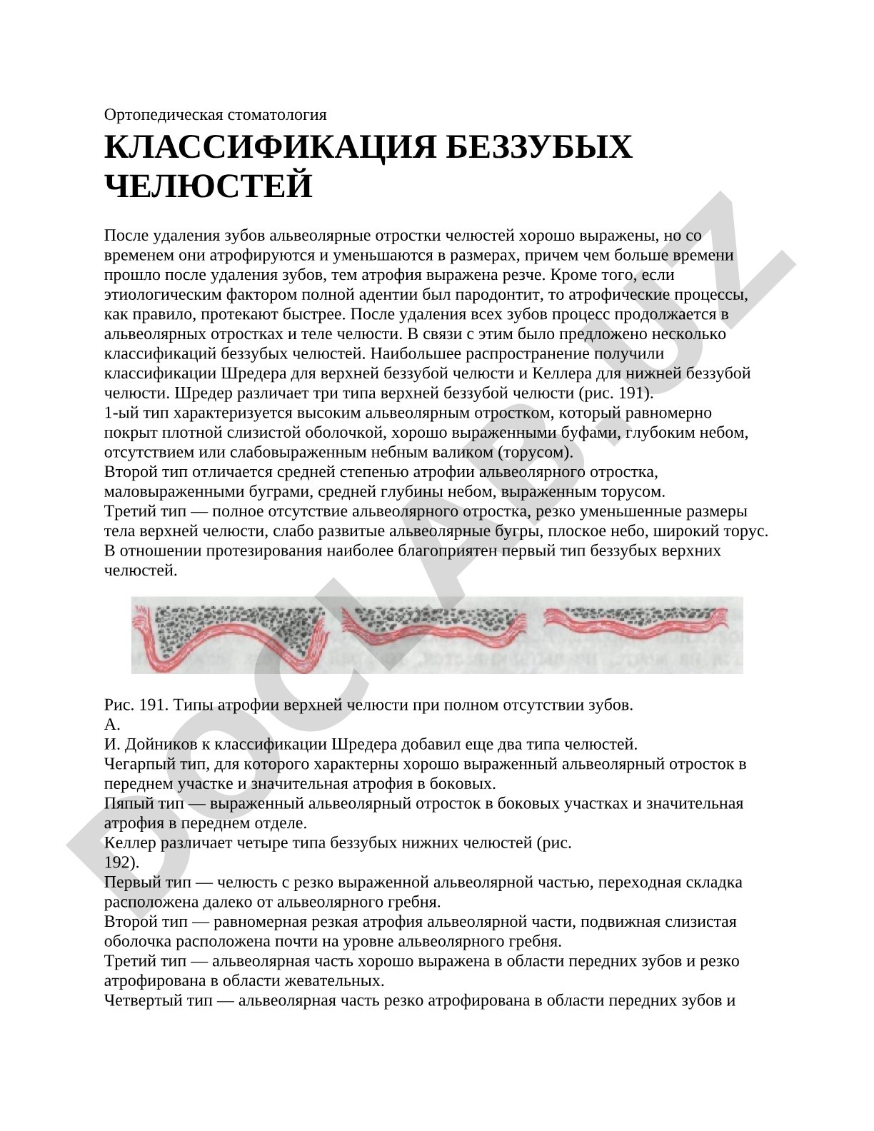 Классификация беззубых челюстей