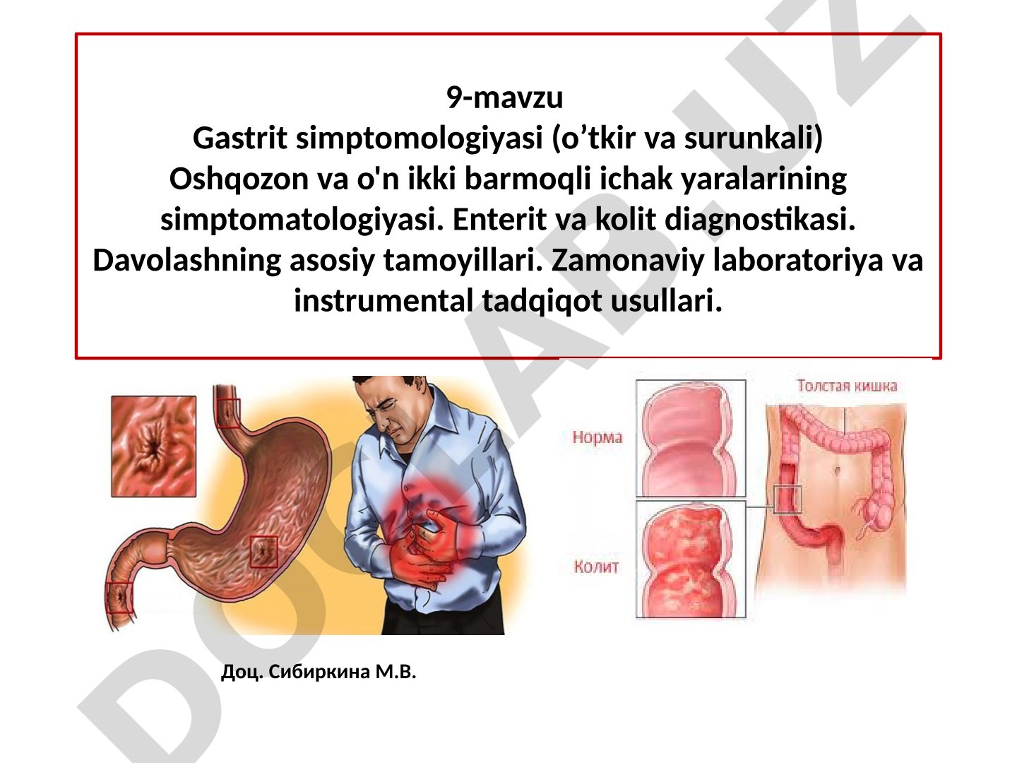 Gastrit simptomologiyasi (o'tkir va surunkali)