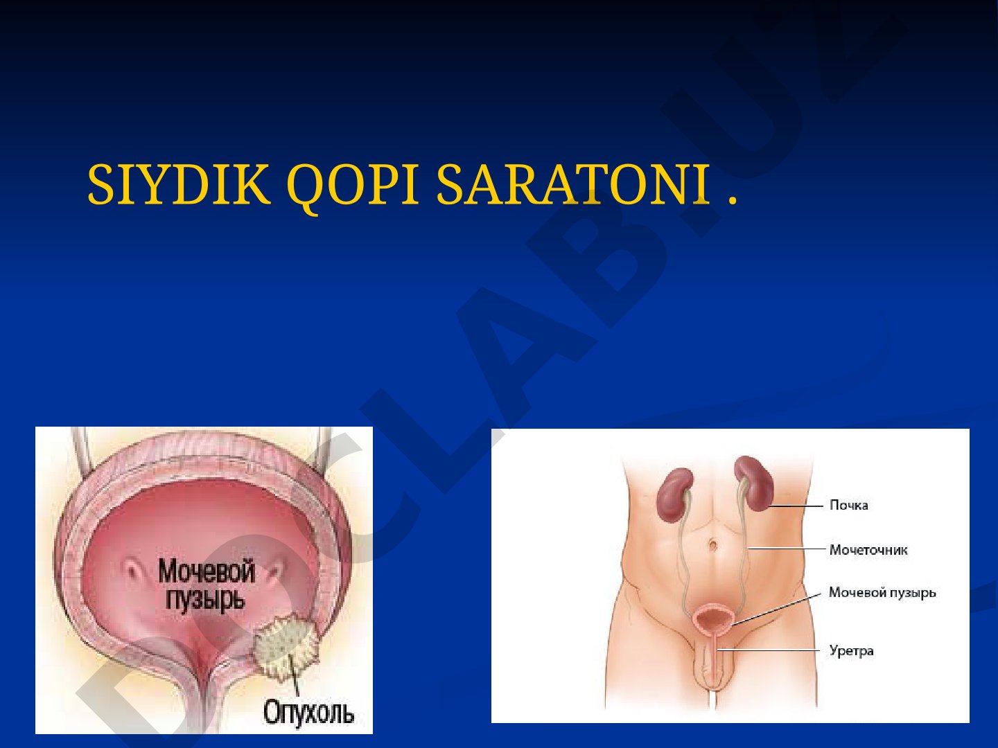 SIYDIK QOPI SARATONI