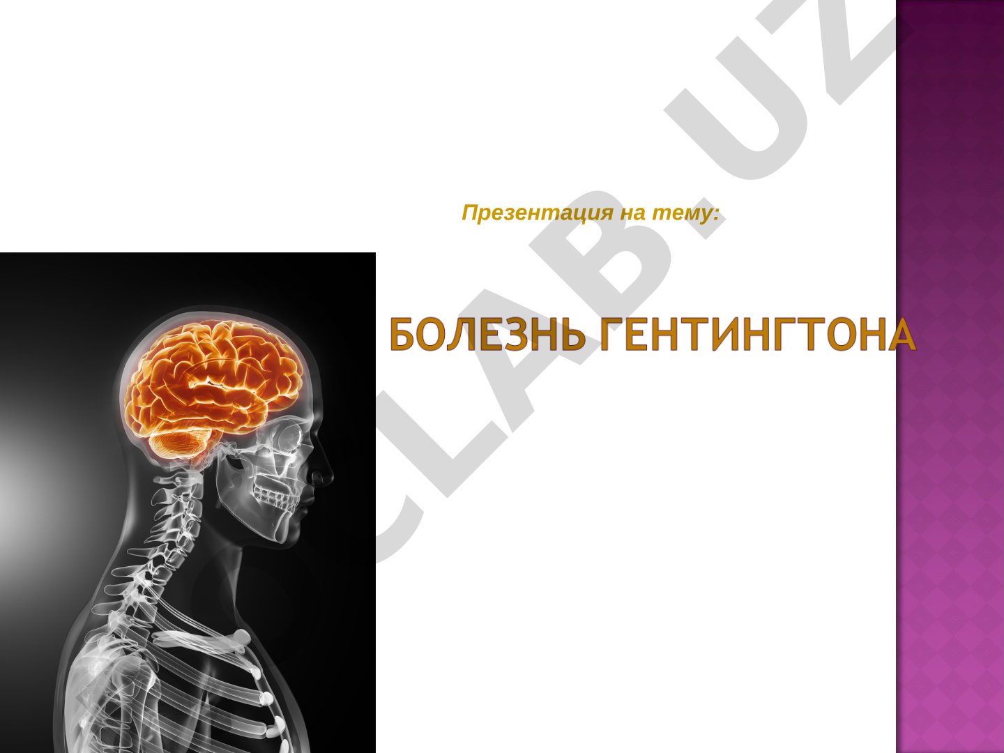 История открытия болезни Гентингтона