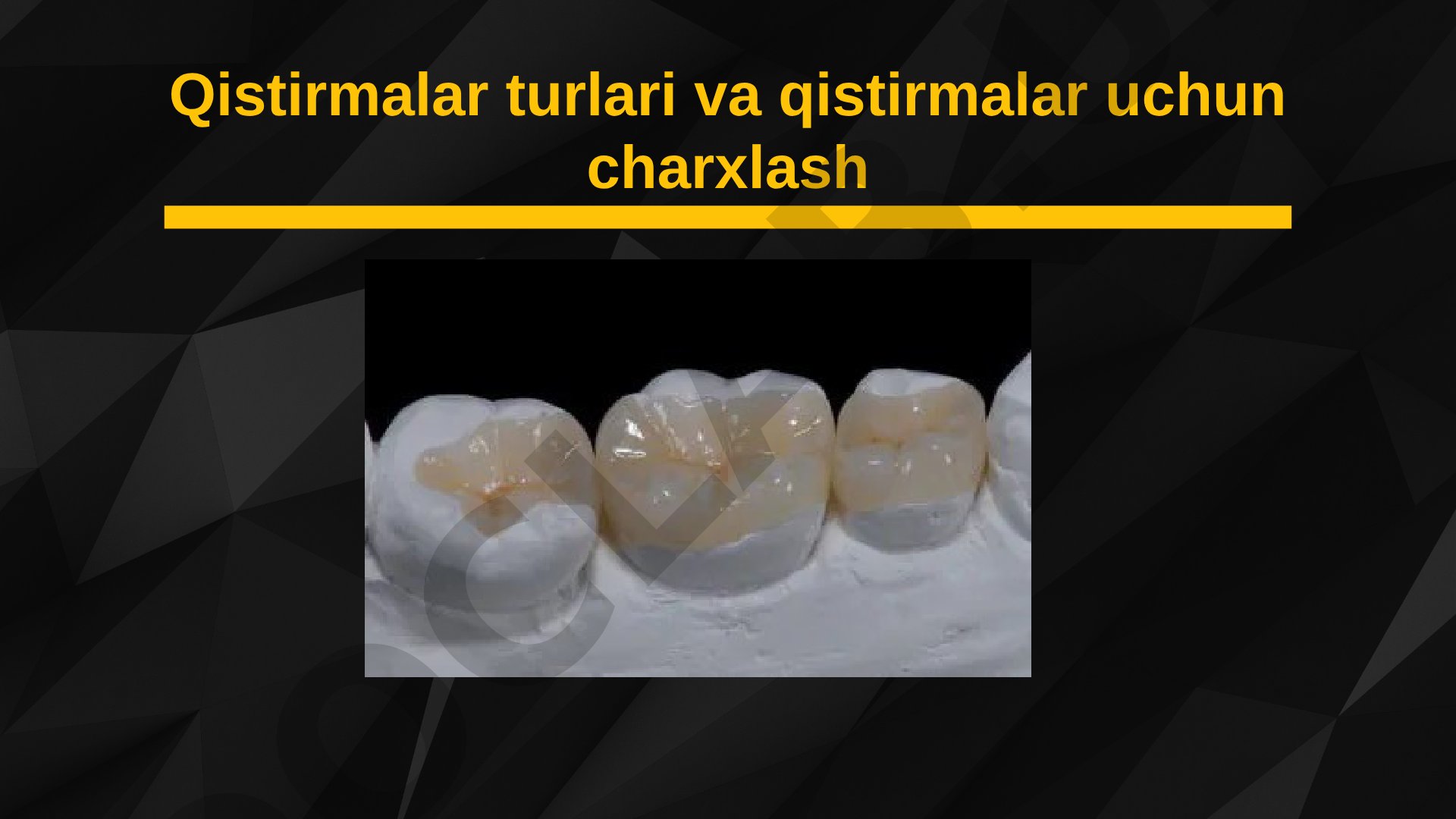 Qistirmalar turlari va qistirmalar uchun charxlash
