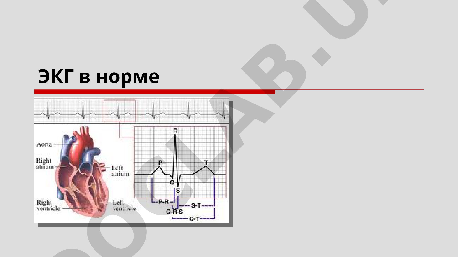Нормальная ЭКГ: расположение электродов и отведения