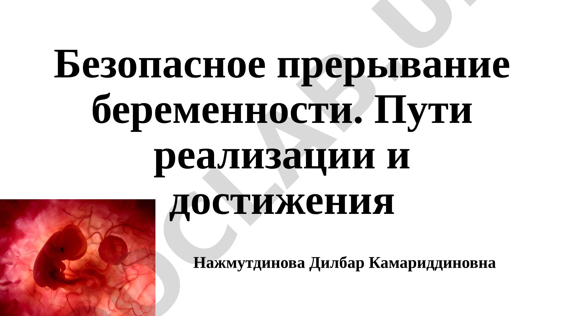 Безопасное прерывание беременности. Пути реализации и достижения