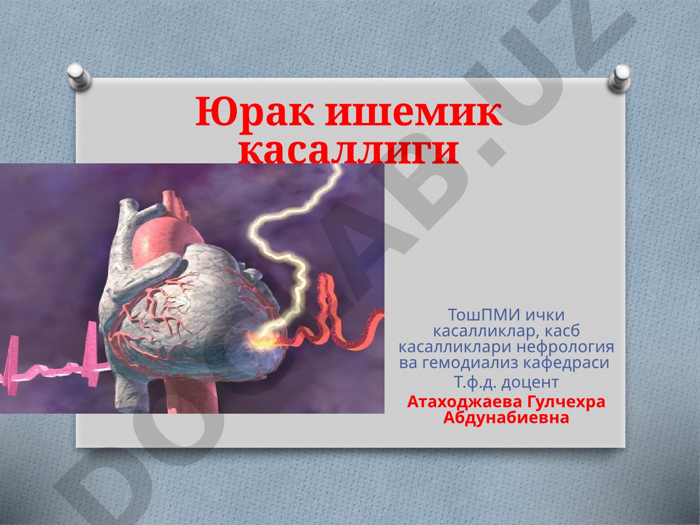 Юрак ишемик касаллиги таснифи ва стенокардия турлари